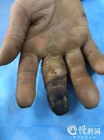 健康與病痛共存