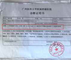 周易運勢揭示肝癌病例