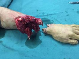 疾患致殘，生活受阻