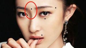 痣中藏佛緣，神佛庇佑顯。