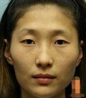 面相苦命，財富絕緣，命運多舛。